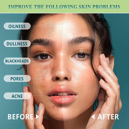 15-Color Waterproof Concealer Palette Pro - Full Coverage Foundation for Acne, Dark Circles, Freckles, Scars, Brightening, Contouring, and Isolation with Free Beauty Egg Brush